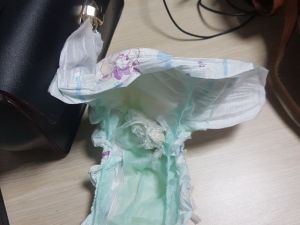 Bebeğin Üzerindeki Bezde Eroin Sakladılar