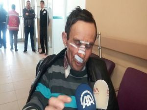 Korkunç Kazayı Anlattı