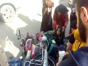 Motosikletin Çarptığı Kadının Ayağına Fren Pedalı Saplandı
