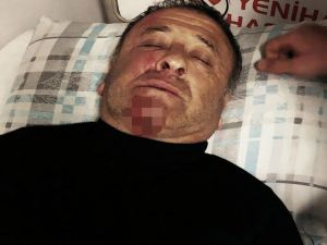 Eski Futbolcu Saldırıya Uğradı