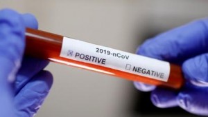Koronavirüs testi 15 dakikada sonuçlanacak