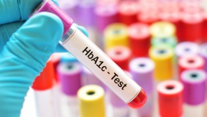 HbA1c Nedir?