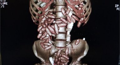 Midesindeki kokain ile yakalandı